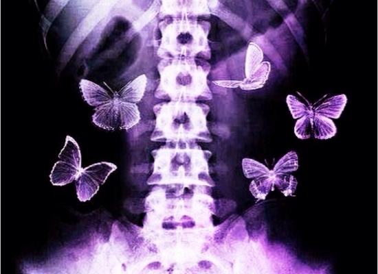 butterflies inside